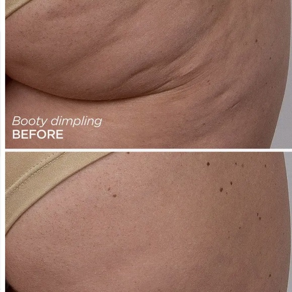 GloPRO BODY MicroTipAttachment Replacement Head - Picture 6 of 7